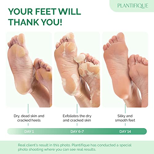 Plantifique Foot Peel Mask – 2 Pairs Exfoliating & Dermatologically Tested Foot Treatment, Removes Dead Skin & Repairs Heels for Soft Feet – Peach Scent, Gift for Women & Men